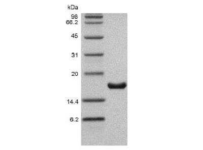 SDS-PAGE: Recombinant Human IL-36 alpha/IL-1F6 Protein [NBP2-34880]