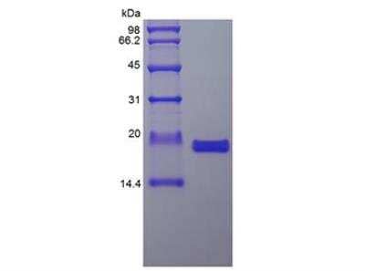 SDS-PAGE: Recombinant Human IL-36 gamma/IL-1F9 Protein [NBP2-34892]