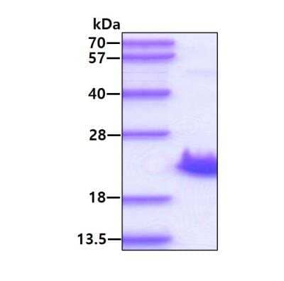 SDS-PAGE: Recombinant Human IL-38/IL-1F10 His Protein [NBP2-22645]