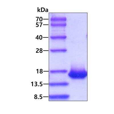 SDS-PAGE: Recombinant Human IL-4 His Protein [NBC1-22613]