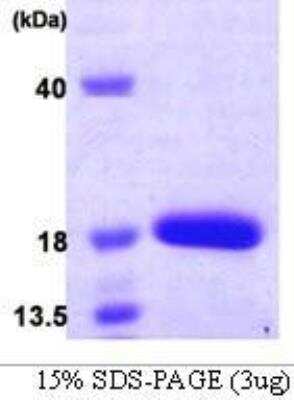 SDS-PAGE: Recombinant Human SF20/MYDGF His Protein [NBC1-22603]