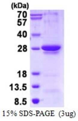 SDS-PAGE: Recombinant Human RGS1 His Protein [NBP1-98956]