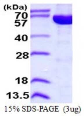 SDS-PAGE: Recombinant Human IMP Dehydrogenase 2/IMPDH2 His Protein [NBP1-72513]