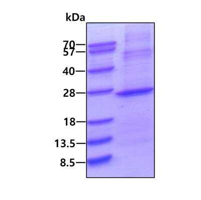 SDS-PAGE: Recombinant Human IMP3 His Protein [NBP2-23134]