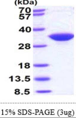 SDS-PAGE: Recombinant Human IMPA1 His Protein [NBP1-49304]