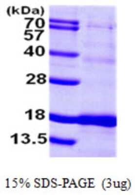 SDS-PAGE: Recombinant Human ISCU His Protein [NBP1-50926]