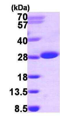 SDS-PAGE: Recombinant Human ITPA His Protein [NBP1-45292]