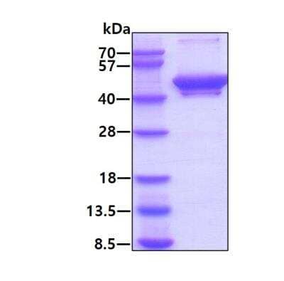 SDS-PAGE: Recombinant Human ITPK1 His Protein [NBP1-98867]