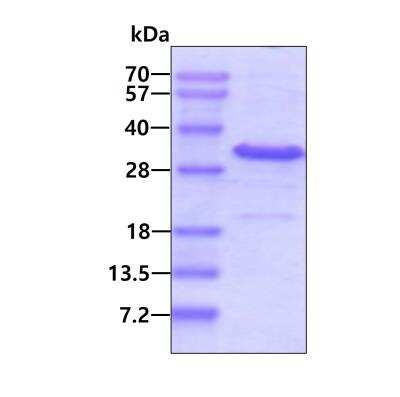 SDS-PAGE: Recombinant Human IYD His Protein [NBP2-51606]