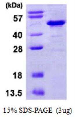 SDS-PAGE: Recombinant Human IkB-beta His Protein [NBP1-99091]