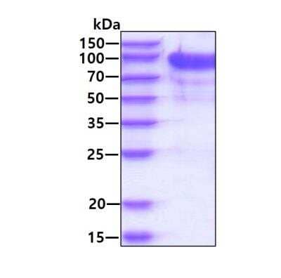 SDS-PAGE: Recombinant Human Importin beta/KPNB1 His Protein [NBP1-78815]