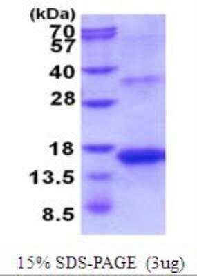 SDS-PAGE: Recombinant Human Activin A His Protein [NBP2-51986]