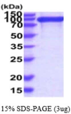 SDS-PAGE: Recombinant Human Integrin beta 1/CD29 His Protein [NBP2-59570]