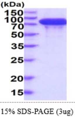 SDS-PAGE: Recombinant Human Integrin beta 4/CD104 His Protein [NBP2-61461]