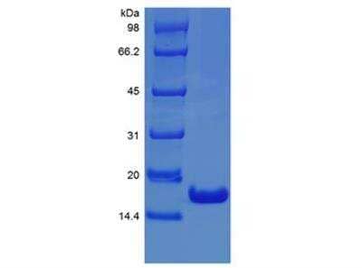 SDS-PAGE: Recombinant Human IFN-alpha 2 Protein [NBP2-34978]