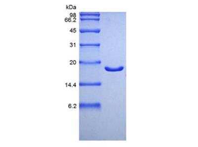 SDS-PAGE: Recombinant Human IFN-alpha 2 Protein [NBP2-34984]