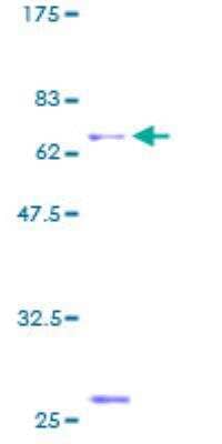 SDS-PAGE: Recombinant Human Intra Acrosomal Protein GST (N-Term) Protein [H00000056-P01]