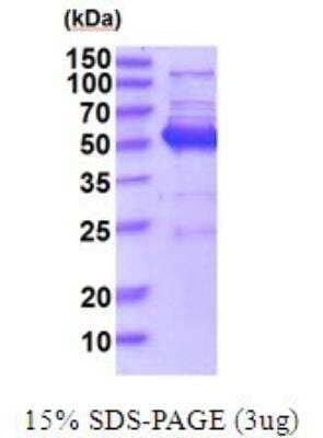 SDS-PAGE: Recombinant Human JNK1 His Protein [NBP2-52123]