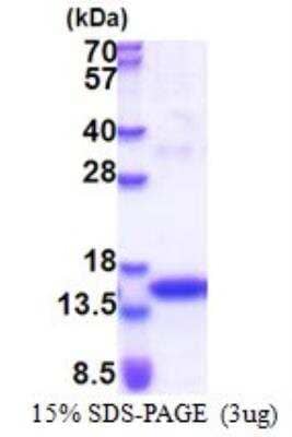 SDS-PAGE: Recombinant Human Jak2 His Protein [NBP2-23154]