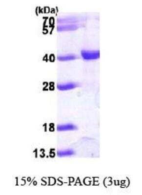 SDS-PAGE: Recombinant Human KAT1 His Protein [NBP1-41234]