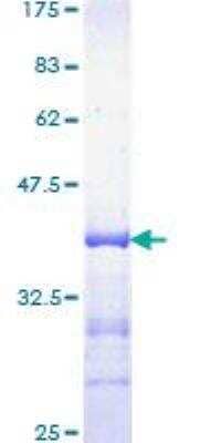 SDS-PAGE: Recombinant Human KAT3B/p300 GST (N-Term) Protein [H00002033-Q01]