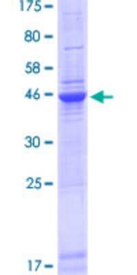 SDS-PAGE: Recombinant Human KBTBD12 GST (N-Term) Protein [H00166348-P01]