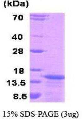 SDS-PAGE: Recombinant Human KISS1 Protein [NBC1-18516]