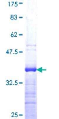 SDS-PAGE: Recombinant Human KLF5 GST (N-Term) Protein [H00000688-Q01]