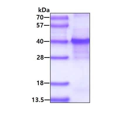 SDS-PAGE: Recombinant Human KLF7 His Protein [NBP2-23176]