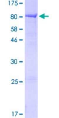 SDS-PAGE: Recombinant Human KLHL2 GST (N-Term) Protein [H00011275-P01]