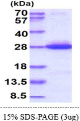 SDS-PAGE: Recombinant Human KRAS His Protein [NBP1-45274]