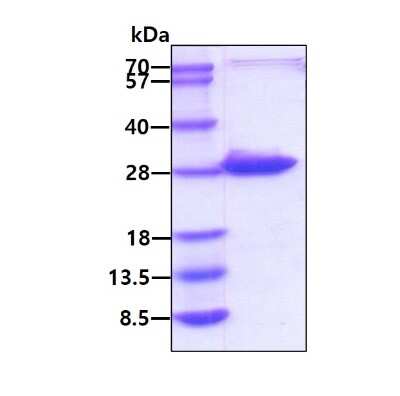 SDS-PAGE: Recombinant Human KRAS His Protein [NBP2-22940]