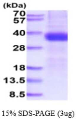 SDS-PAGE: Recombinant Human Kallikrein 15 His Protein [NBP2-59595]