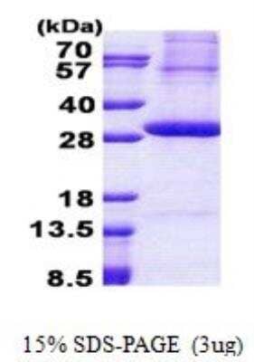 SDS-PAGE: Recombinant Human Kallikrein 2 His Protein [NBP2-51511]