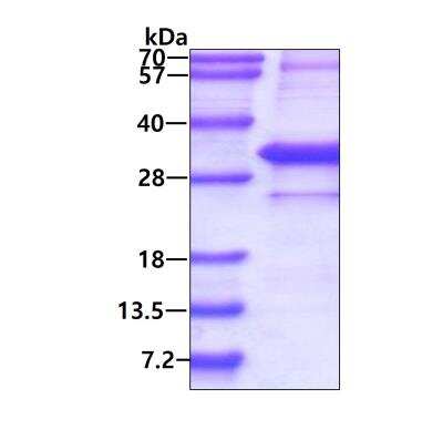 SDS-PAGE: Recombinant Human Kallikrein 3/PSA His Protein [NBP1-98962]