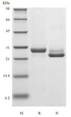 SDS-PAGE: Recombinant Human Kallikrein 3/PSA Protein [NBP2-61380]