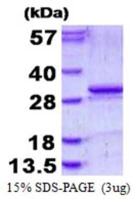 SDS-PAGE: Recombinant Human Kallikrein 5 His Protein [NBP1-98905]