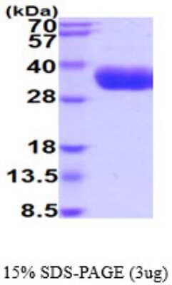 SDS-PAGE: Recombinant Human Kallikrein 5 His Protein [NBP2-59548]