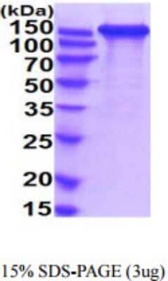 SDS-PAGE: Recombinant Human L1CAM His Protein [NBP2-59904]