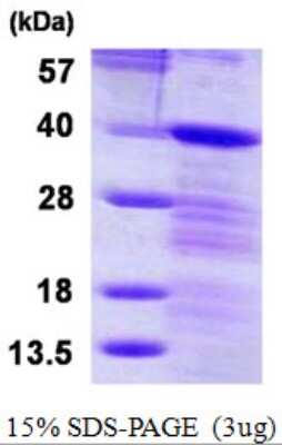 SDS-PAGE: Recombinant Human LASP1 His Protein [NBP1-78885]