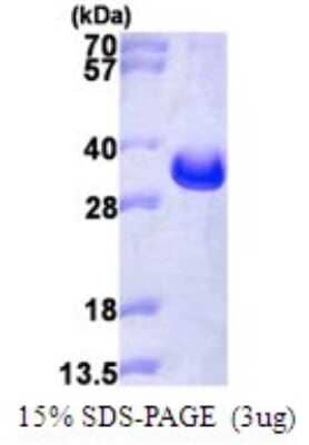 SDS-PAGE: Recombinant Human LAT His Protein [NBP1-72479]