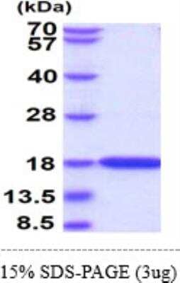 SDS-PAGE: Recombinant Human LC3A His Protein [NBP1-45308]