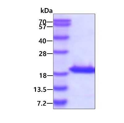 SDS-PAGE: Recombinant Human LC3B His Protein [NBP1-50960]