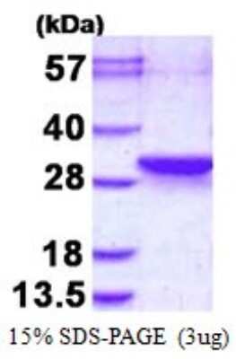 SDS-PAGE: Recombinant Human LDOC1L His Protein [NBP1-98903]