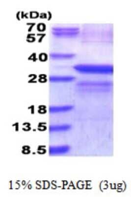 SDS-PAGE: Recombinant Human LOX His Protein [NBP2-59887]