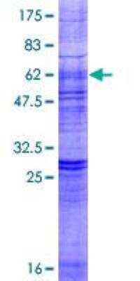 SDS-PAGE: Recombinant Human LPAR3/LPA3/EDG-7 GST (N-Term) Protein [H00023566-P01]