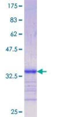 SDS-PAGE: Recombinant Human LRP-5 GST (N-Term) Protein [H00004041-Q01]