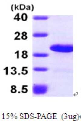 SDS-PAGE: Recombinant Human LSM1 His Protein [NBP1-49169]