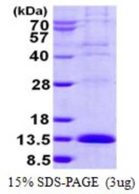 SDS-PAGE: Recombinant Human LSM2 His Protein [NBP1-99048]