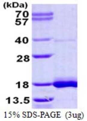 SDS-PAGE: Recombinant Human LSM3 His Protein [NBP1-99062]